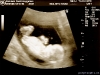 baby2.jpg